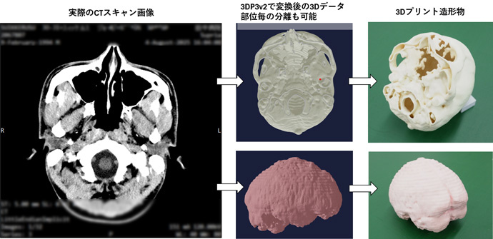 図6. CTスキャンデータから3Dプリントまでのワークフロー例