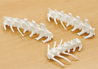 術前シミュレーション用の骨格模型