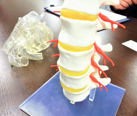 3Dプリンタで造形された臓器模型